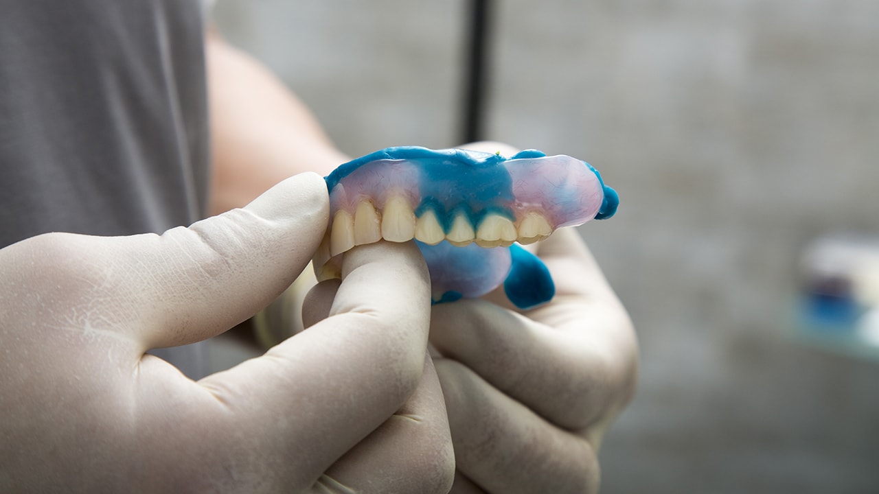 a person holds a pair of dentures